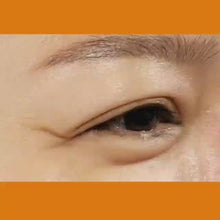 Load and play video in Gallery viewer, 50% OFF ON PLASMA LIFT: CROW'S FEET - 4 SESSIONS *