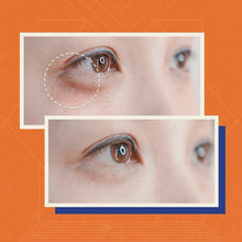 Load image into Gallery viewer, 50% OFF ON PLASMA LIFT: LOWER EYELID - 4 SESSIONS *