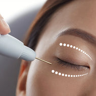 60% OFF ON PLASMA LIFT: UPPER AND LOWER EYELID (4 SESSIONS) *