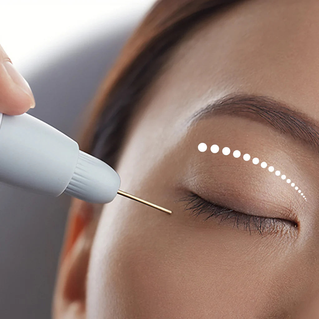 50% OFF ON PLASMA LIFT: UPPER EYELID 1 SESSION