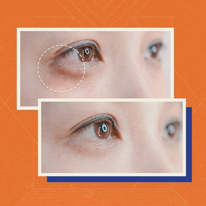 Browhaus 50% OFF ON PLASMA LIFT: LOWER EYELID 1 SESSION