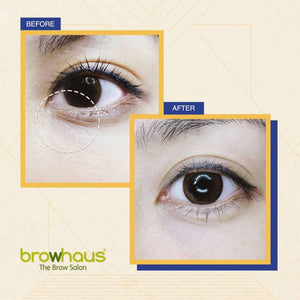 Browhaus 50% OFF ON PLASMA LIFT: LOWER EYELID 1 SESSION