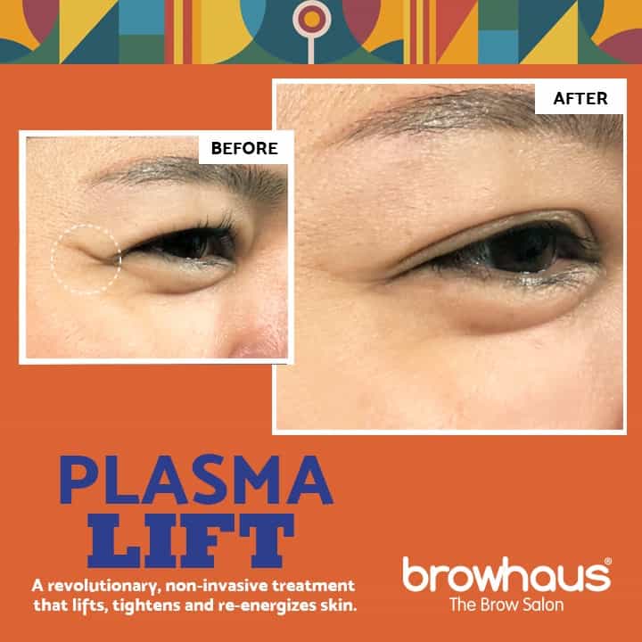 Browhaus 50% OFF ON PLASMA LIFT: CROW'S FEET 1 SESSION
