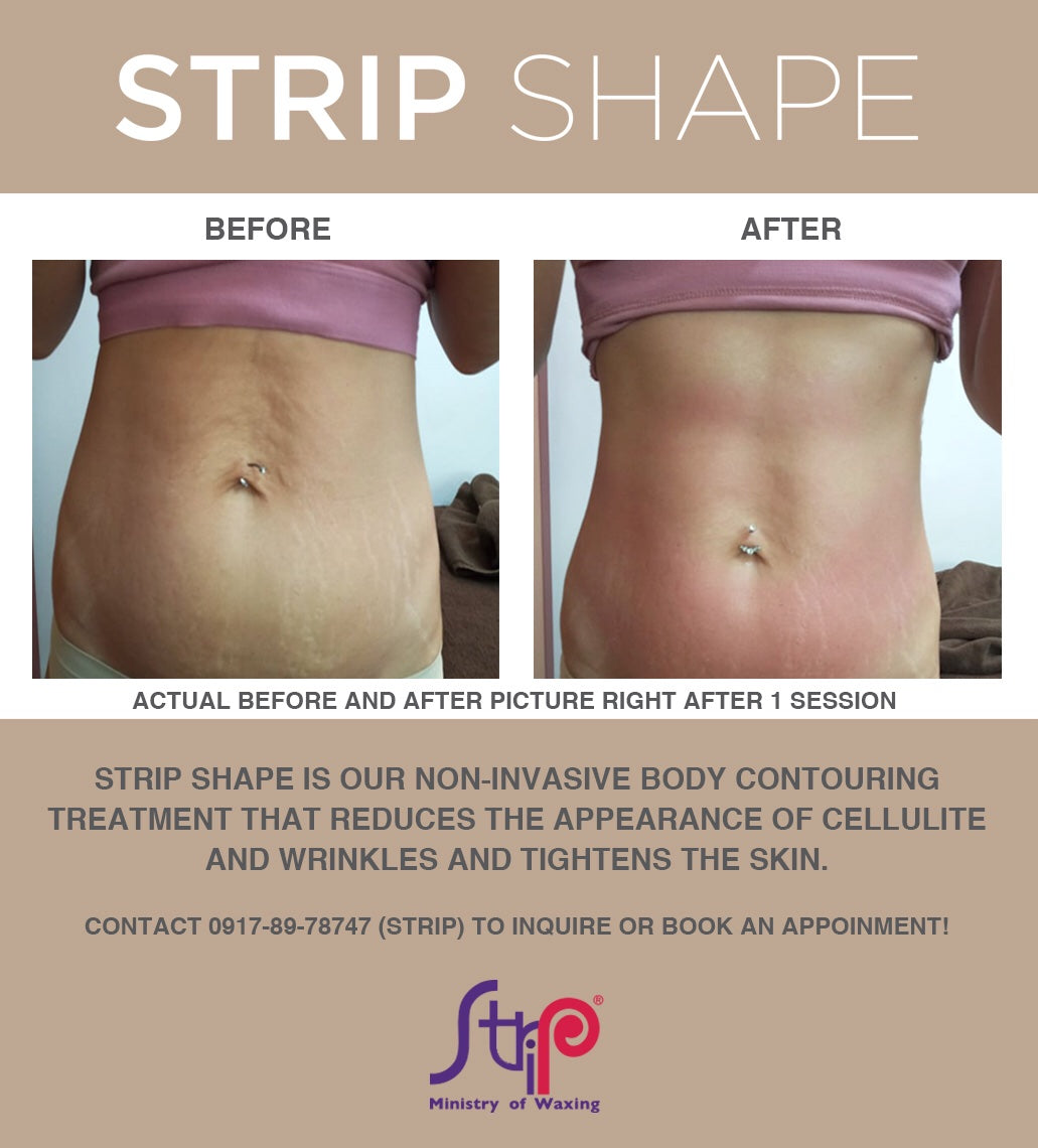 50% OFF ON 1 SESSION OF STRIP SHAPE STOMACH (FOR FEMALE) – Cult Favorites  Unlimited Inc.