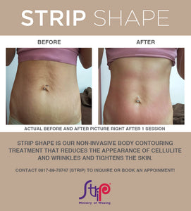 50% OFF ON 1 SESSION OF STRIP SHAPE STOMACH (FOR FEMALE)